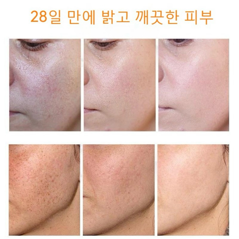 Kem mờ nám-tàn nhang nội địa Hàn/ Cam kết mờ nám sau 28 ngày