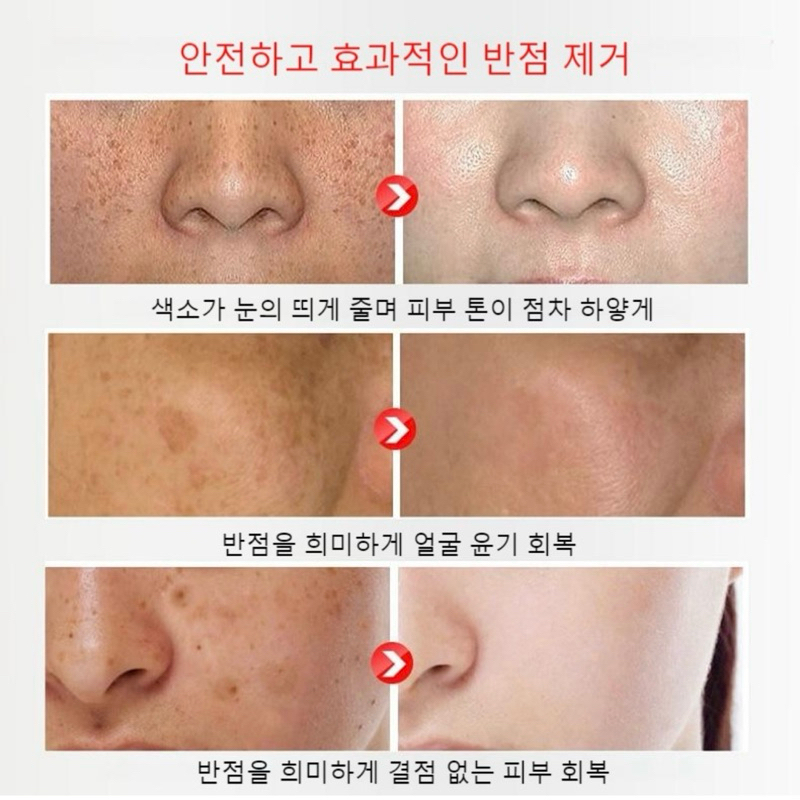 Kem mờ nám-tàn nhang nội địa Hàn/ Cam kết mờ nám sau 28 ngày