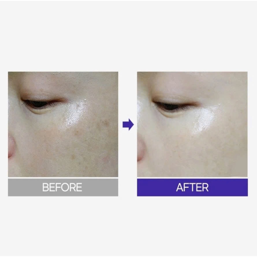 Kem mắt Maxclinic Time Return Melatonin Eye Cream Hàn Quốc 20g giảm quầng thâm, bọng mắt, nếp nhăn