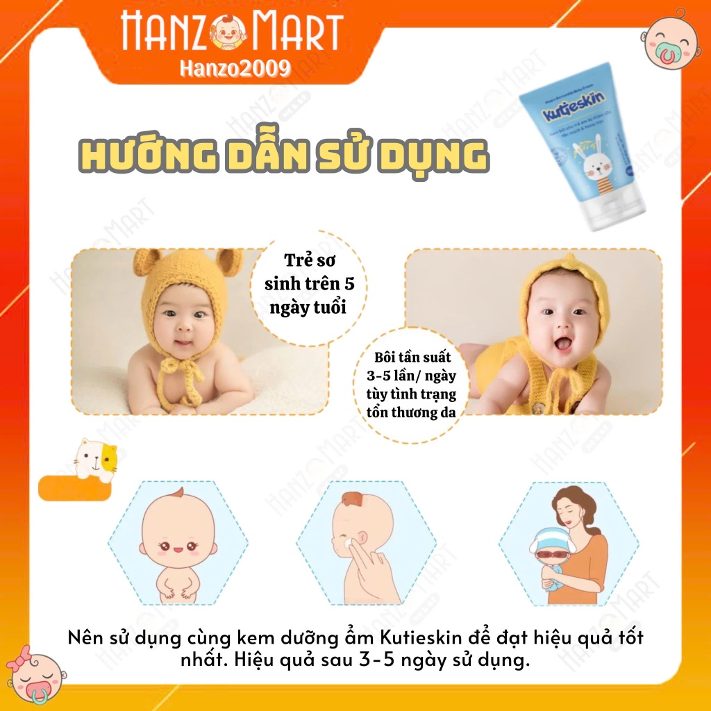 Kem bôi cho trẻ em bị chàm sữa - Kutieskin