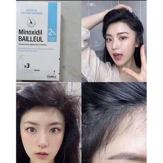 Xịt Mọc Tóc Minoxidil Bailleul 2%