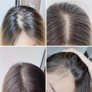 Xịt Mọc Tóc Minoxidil Bailleul 2%