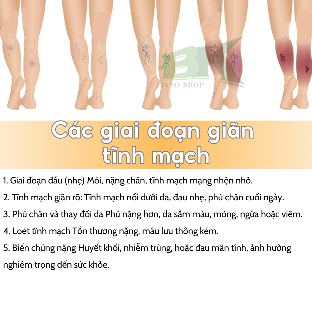 Chất lượng Miếng Dán Tiêu Chuẩn