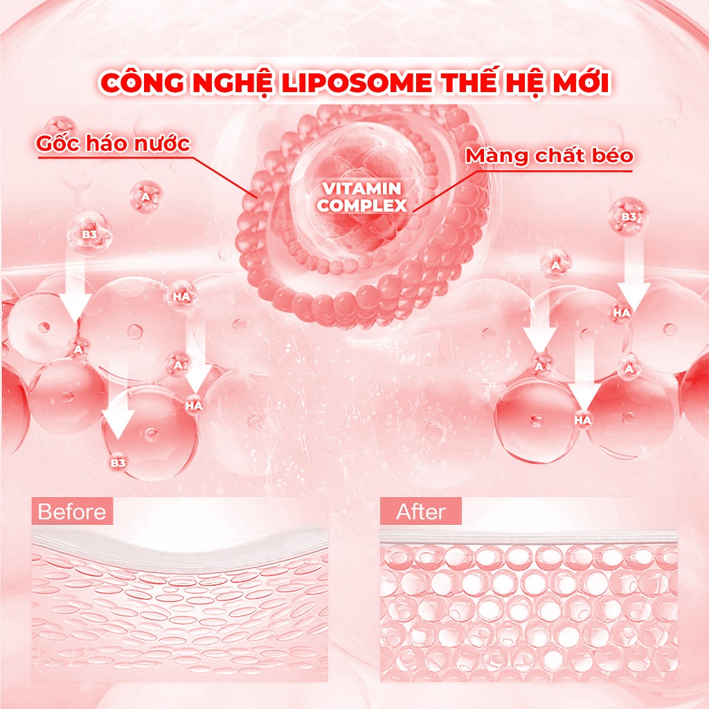 Ảnh Combo 10 Mặt Nạ BNBG Hỗ Trợ Nâng Cơ, Săn Chắc Da BNBG Vita Genic Lifting Jelly Mask 30mlx10 4