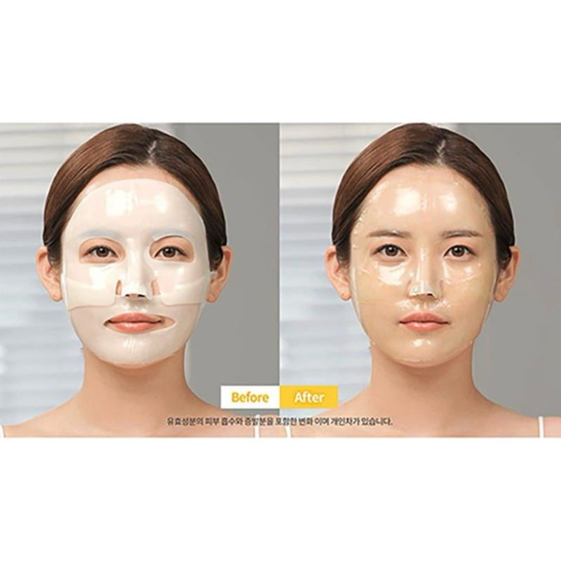Mặt nạ thạch Collagen Medi Answer Vita Collagen Mask phiên bản đặc biệt.