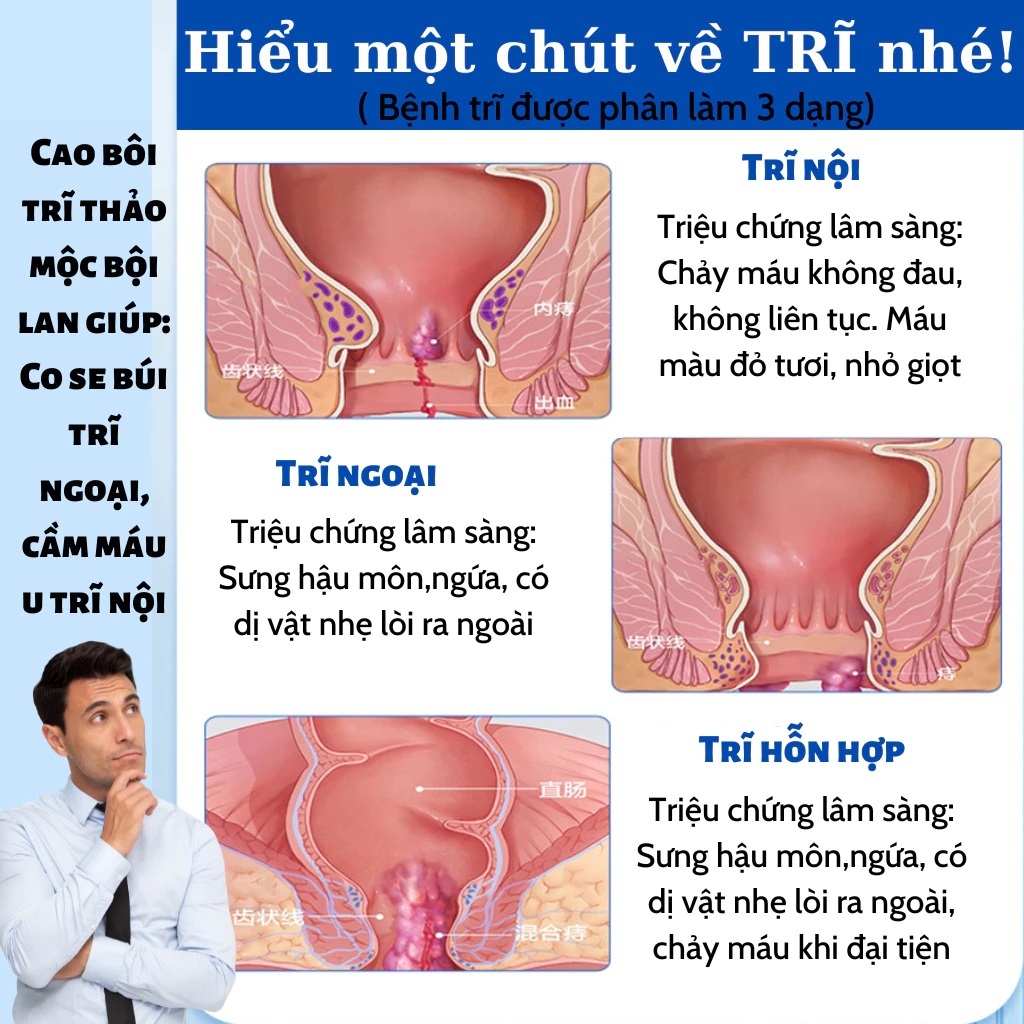 [Có Che Tên] Kem Bôi Trĩ - Bội Lan Đường - Trĩ nội, trĩ ngoại, Táo Bón, ngứa rát Hậu Môn, Giúp Co Nhanh Búi Trĩ - hũ 20g