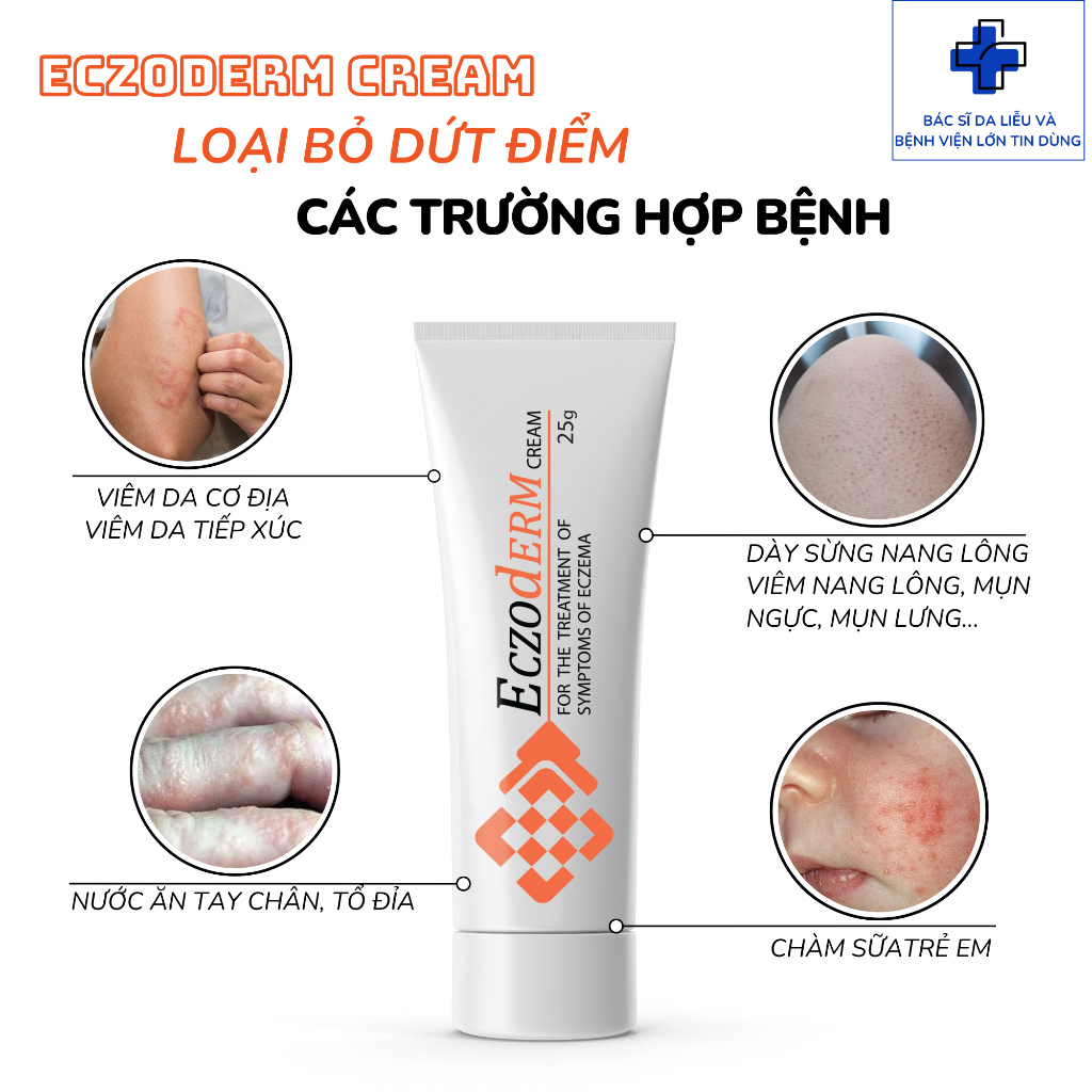 Kem Eczoderm Hỗ Trợ Eczema,Viêm Nang Lông, Viêm Da Cơ Địa, Mụn Lưng, Mụn Cơ thể, Chàm Sữa Chính Hãng