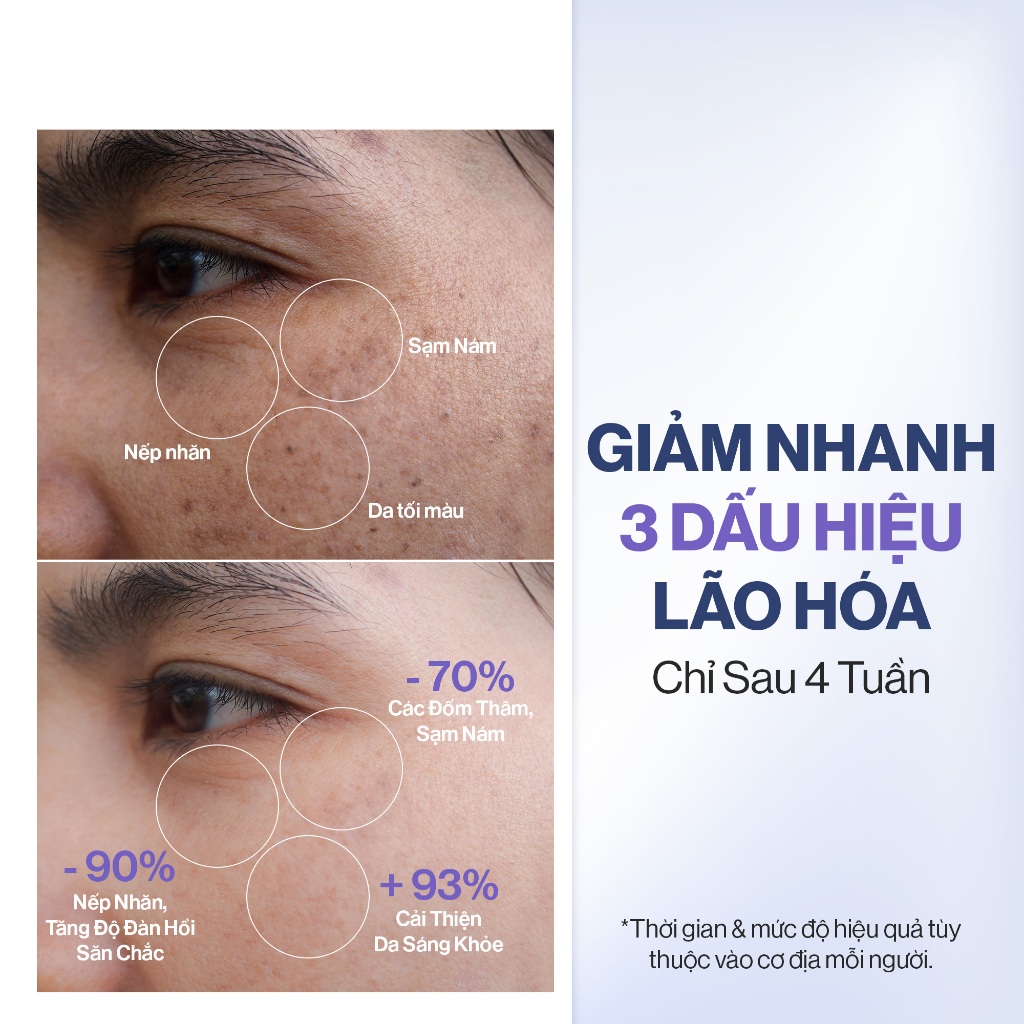 Ảnh Combo 4 Hộp Nước Uống Collagen Gilaa Siêu Phân Tử 300da Trẻ Hóa (20g X 60 Gói) 4