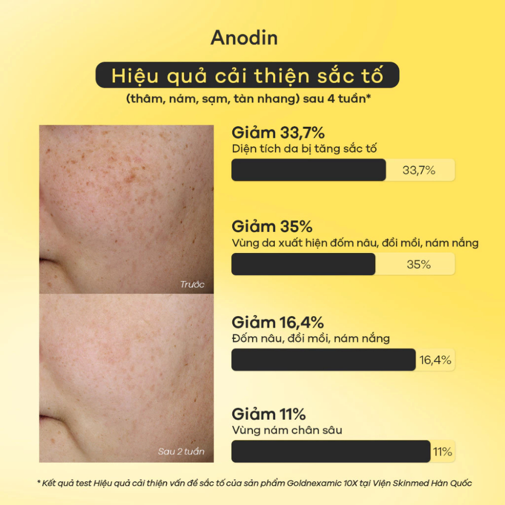 Serum dưỡng sáng, mờ thâm nám đa tầng Goldnexamic 10X Anodin 30ml - Skin Studio