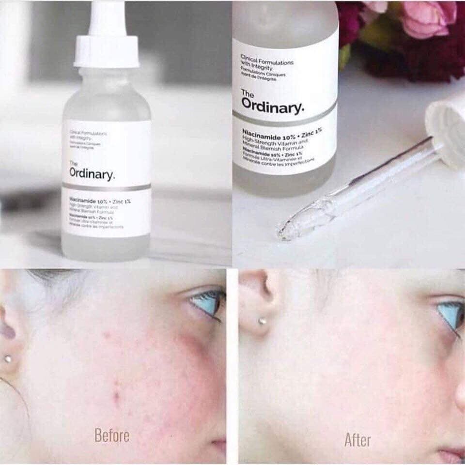 Tinh Chất Dưỡng Da Ordinary Full Size 30ml