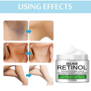 Retinol Nách Trắng Da Mặt Sáng Nách Chân Đầu Gối Tư Nhân Phần Làm Trắng Da Toàn Thân 30ML JULYSTAR
