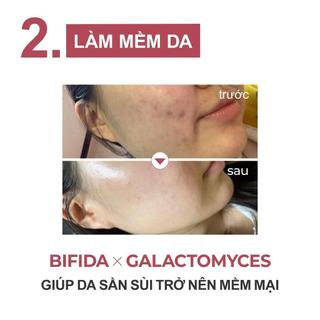 Tinh chất sáng da, mờ thâm mụn NUMBUZIN No.5 Goodbye Blemish Serum 50ml