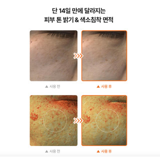 Tinh chất dưỡng trắng DR.ALTHEA Vitamin C 63% Boosting Serum 30ml