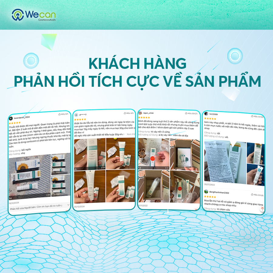 Ảnh Kem Bôi Viêm Da Cơ Địa SODERMIX 30gr - Hỗ Trợ Giảm Ngứa Ngáy Lâu Năm, Eczema, Chàm Sữa, Tổ Đỉa - Dưỡng Ẩm - Nhập Pháp 3