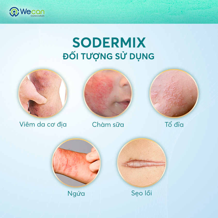 Ảnh 2 SODERMIX 15g - Tặng Kem Helia - Kem Bôi Viêm Da Cơ Địa Hỗ Trợ Ngứa Ngáy, Eczema, Chàm Sữa, Tổ Đỉa, Dưỡng Ẩm 3