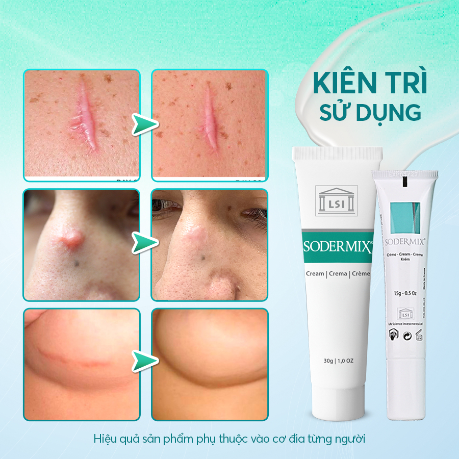 Ảnh Kem Bôi Sẹo Lồi, Sẹo Phì Đại - SODERMIX - Hỗ Trợ Làm Xẹp Sẹo Lồi, Sẹo Phì Đại, Mờ Sẹo Thâm - Nhập Từ Pháp 1