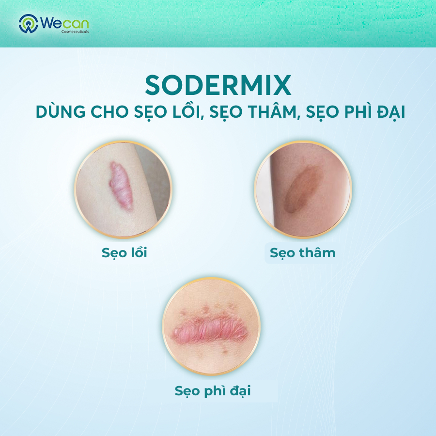 Ảnh Kem Bôi Sẹo Lồi, Sẹo Phì Đại - SODERMIX - Hỗ Trợ Làm Xẹp Sẹo Lồi, Sẹo Phì Đại, Mờ Sẹo Thâm - Nhập Từ Pháp 2