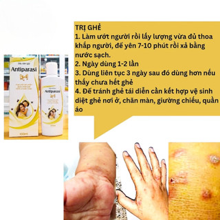 Dầu Gội Diệt Chí Antiparasi 3in1 100ml | Cho Bé Và Người Lớn - Sạch Chấy Giảm Ngứa Da Đầu Thảo Dược