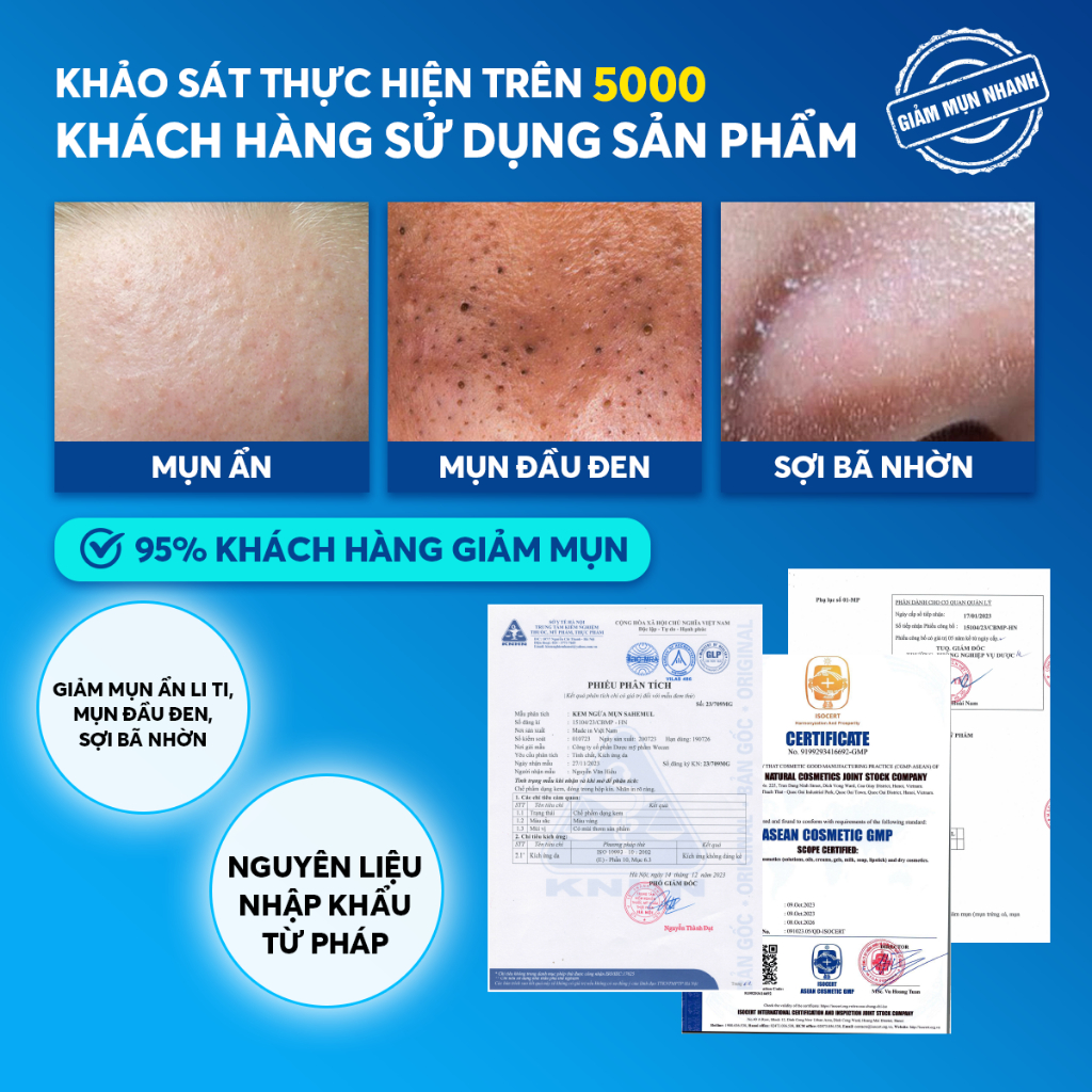 Ảnh Gel Giảm Mụn Sahemul Sensitive Giảm Mụn Viêm, Mụn Ẩn, Mụn Đầu Đen 20gr [TẶNG KEM MỤN 10GR] 2