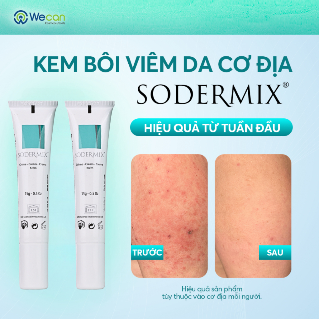 Ảnh 2 SODERMIX 15g - Tặng Kem Helia - Kem Bôi Viêm Da Cơ Địa Hỗ Trợ Ngứa Ngáy, Eczema, Chàm Sữa, Tổ Đỉa, Dưỡng Ẩm 1