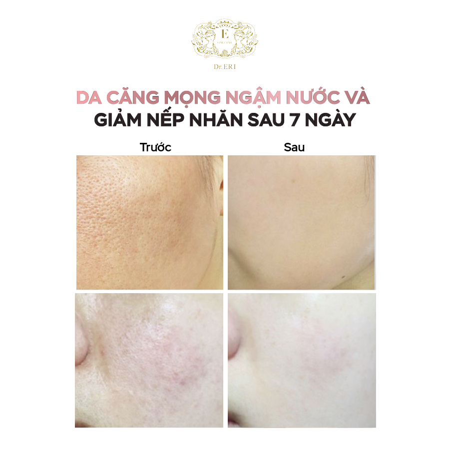 Tinh chất E-SPECIAL MOISTURE GEL Cô Đặc Hỗ Trợ Dưỡng Căng Bóng Da 100ml [NHẬP KHẨU NHẬT BẢN]