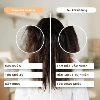 COMBO Nuôi Dưỡng Tóc Konus Homespa Mềm Mượt Tự Nhiên, Ngăn Ngừa Gãy Rụng