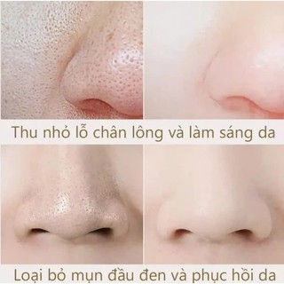 Serum se khít lỗ chân lông EELHOE lactobionic acid ceramide làm căng da tẩy tế bào chết 30ml