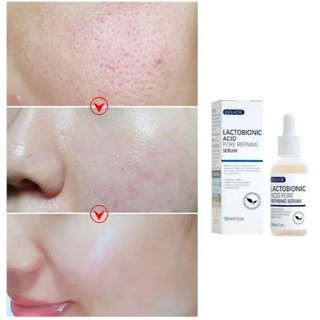 Serum se khít lỗ chân lông EELHOE lactobionic acid ceramide làm căng da tẩy tế bào chết 30ml