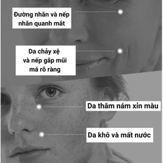 Kem Giảm Nám Chống Nhăn và Trẻ Hóa Da YIJIYAN