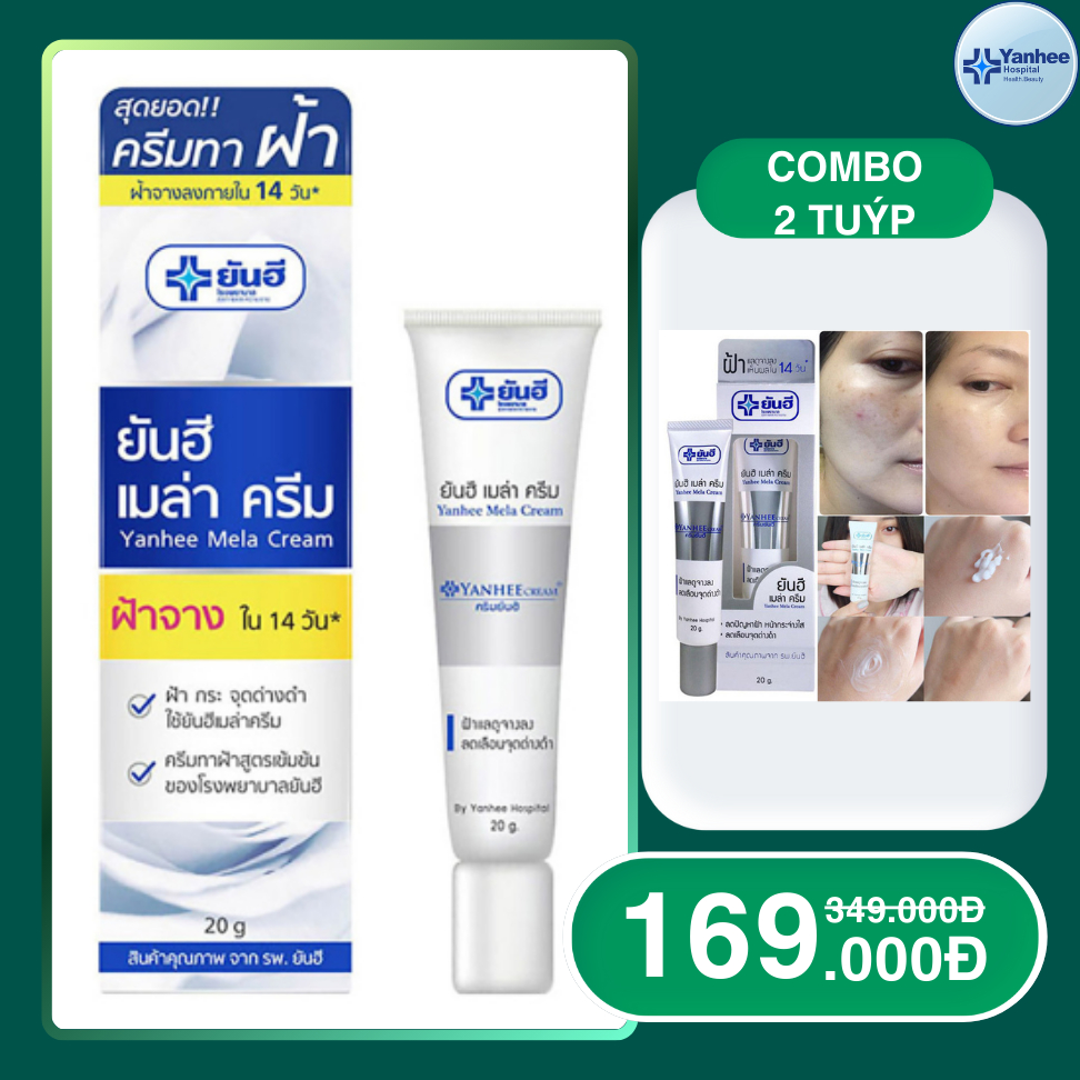 Kem Nám Tàn Nhang, Serum nám YANHEE Weilaiya Cao Cấp Mờ Nám Tàn Nhang Đồi Mồi Dưỡng Ẩm Da, Phục Hồi Chống Lão Hóa Da