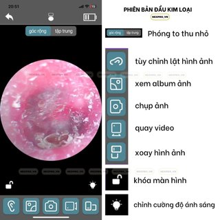 Lấy ráy tai có camera , bộ lấy ráy tai nội soi thông minh - lấy ráy tai có đèn cho bé , người lớn -bảo hành 6 tháng