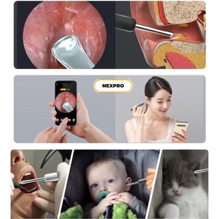 Lấy ráy tai có camera , bộ lấy ráy tai nội soi thông minh - lấy ráy tai có đèn cho bé , người lớn -bảo hành 6 tháng