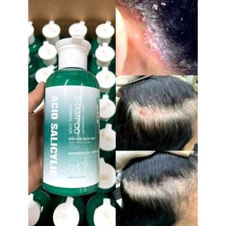 [Hàng Chuẩn] Dầu gội L'eva Anti Dandruff chai 450ml giảm gàu, nấm ngứa da đầu AZ008