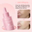 Tinh Chất Niacinamide 15% Làm Sáng Da, Giảm Thâm Mụn, Cân Bằng Dầu Nhờn – Thẩm Thấu Nhanh