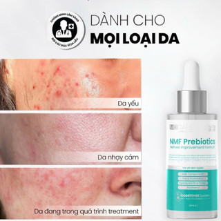 Serum Cân Bằng Lợi Khuẩn Và Phục Hồi Hàng Rào Bảo Vệ Da MD CARE NMF Prebiotics Serum (30ml)
