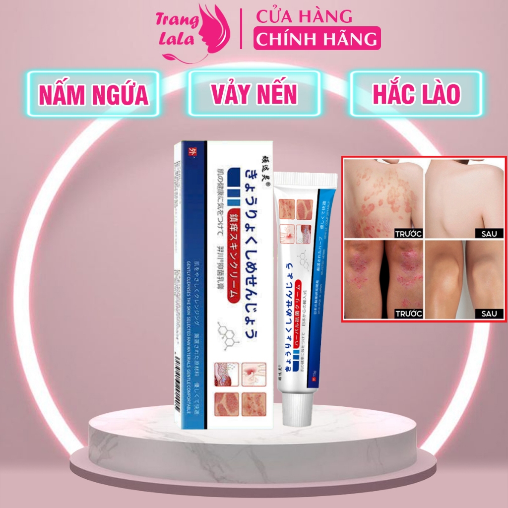 Kem Bôi Nấm Ngứa Viêm Da Cơ Địa NHẬT BẢN dứt điểm Nấm Da đầu, Ghẻ nước Tay Chân, Hắc lào, Tổ đỉa, Vẩy nến Hiệu Quả