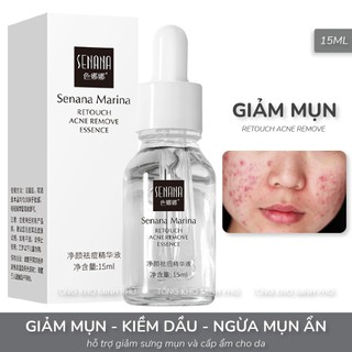 SERUM Trắng Da, Ngừa Mụn Senana 15ml Trẻ Hoá Da, Kiểm Soát Dầu, Dưỡng Ẩm