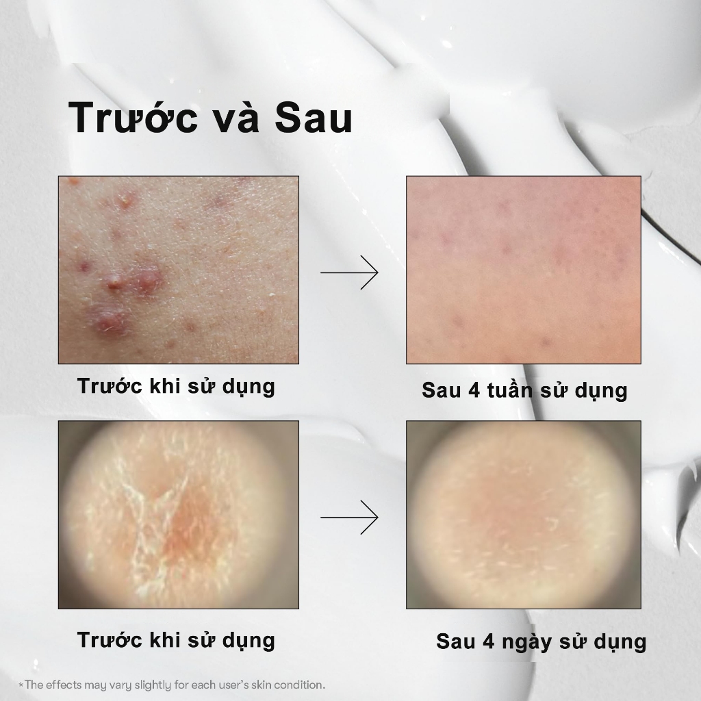 VT Cosmetics REEDLE SHOT Serum Tăng Cường Dưỡng Chất 100 50ml khởi động da, cải tiến hấp thụ da, Reedle Shot 100