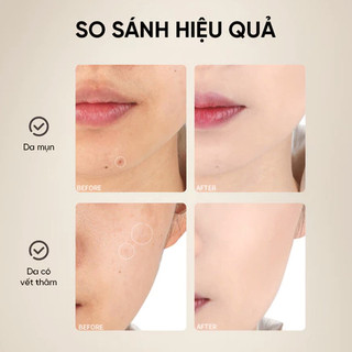 Cọ Mút Che Khuyết Điểm Amortals 2 Đầu Chuyên Dụng, Mềm Mịn, Không Tì Vết (1 Thân Cọ + 4 Đầu Cọ)