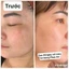 Tinh chất xử lý nám PAG+ và PAG++ Sữa Non PHAN AN GREEN phục hồi tái tạo căng bóng da sau peel tế bào gốc PAG+2