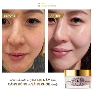 Bộ kit dưỡng da cấp ẩm chuyên sâu tiện lợi E-Special Travel Set 4 món