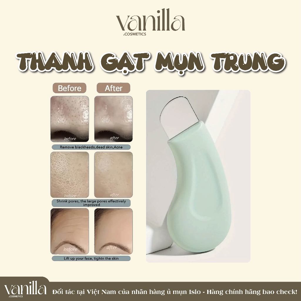 (Mua 1 Tặng 1) Thanh đẩy mụn cám mụn đầu đen chuyên dụng VANILLA COSMETICS
