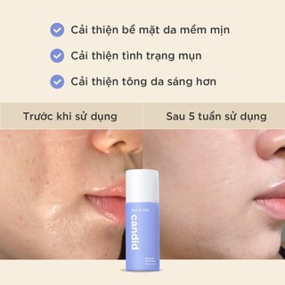 Gel Tẩy Tế Bào Chết C.a.nd.i.d AHA & PHA Gel Exfoliant Làm Mịn Da Khô, Da Nhạy Cảm 5ml Duduhouse