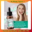 Serum và Kem dưỡng Compliment Azelaic Acid giảm thâm mụn, đều màu da 27ml của Nga