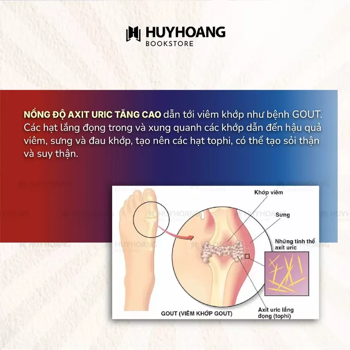 Vietnamese Book · Chỉ Tại Axit Uric, chăm sóc sức khỏe, sách y học, kiến thức y học, áp dụng thực tế – 4