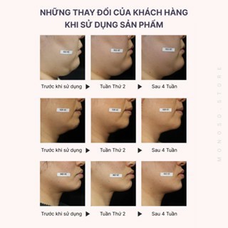 Máy Chăm Sóc Da Mặt Thon Gọn Vline, Nâng Cơ Chống Lão Hoá Bằng Ánh Sáng Sinh Học Bảo Hành 12 Tháng - Aimanfun Việt Nam