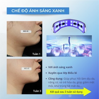 [Mẫu Mới 2026] Máy Massage Mặt Dạng Đeo Hỗ Trợ Săn Chắc Da – Chăm Sóc Vùng Cằm & Gò Má