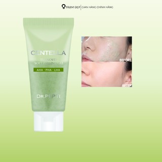 Gel Tẩy Tế Bào Chết Chiết Xuất Rau Má Centella Turnover Soft Peeling Gel (30ml)