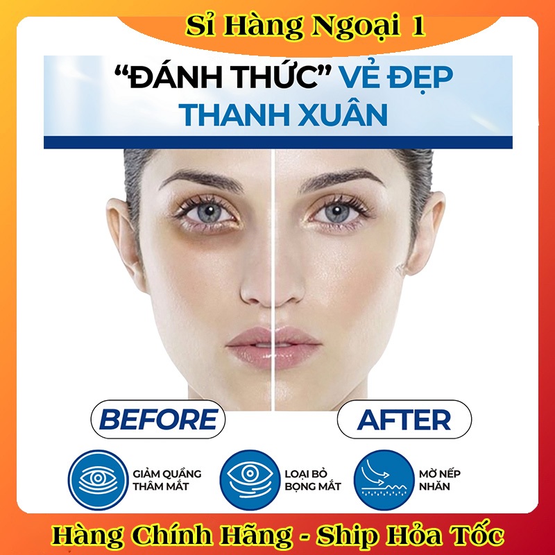 Thanh lăn vùng mắt giúp giảm quầng thâm, nếp nhăn Compliment Beauty Vision HD 11ml của Nga