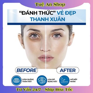 Thanh Lăn Giảm Thâm Quầng Mắt, Xóa Bọng Mắt Compliment Eye 11ml của Nga